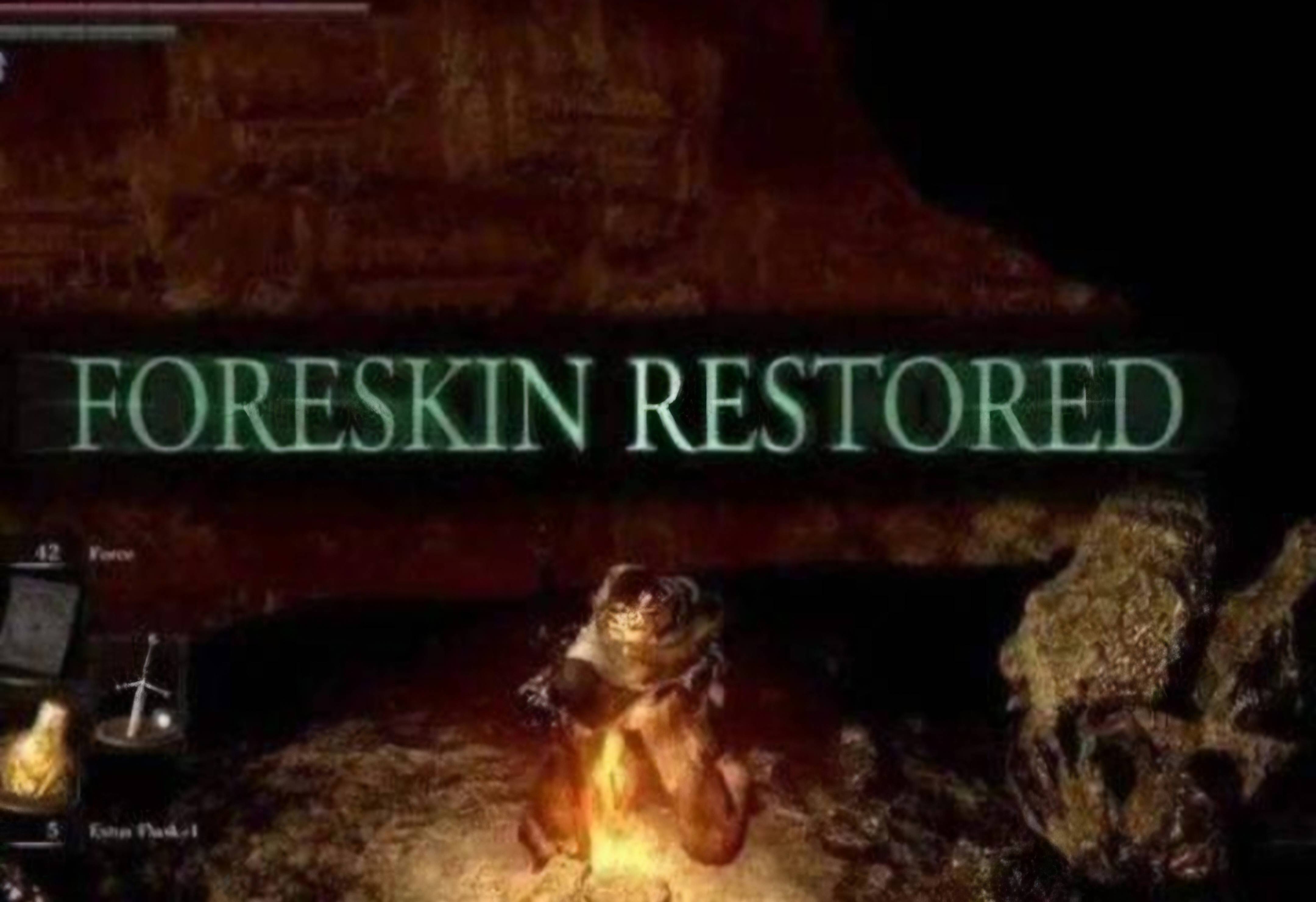 foreskin restored 