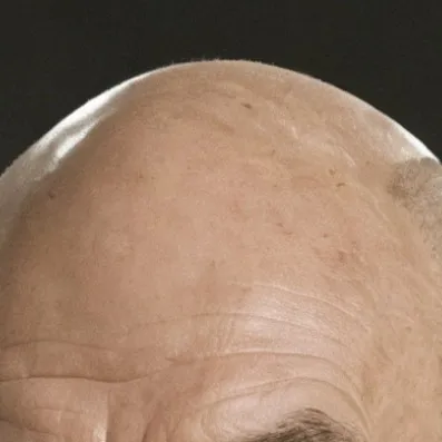 creator Picards Bald Spot's avatar